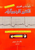 خواندن فوری الکتروکاردیوگرام